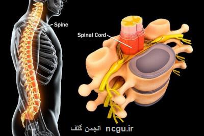 دیسک کمر چگونه پاره می شود؟