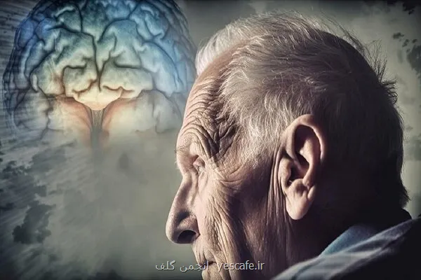 مصرف نمک می تواند مشکلات حافظه را تشدید کند